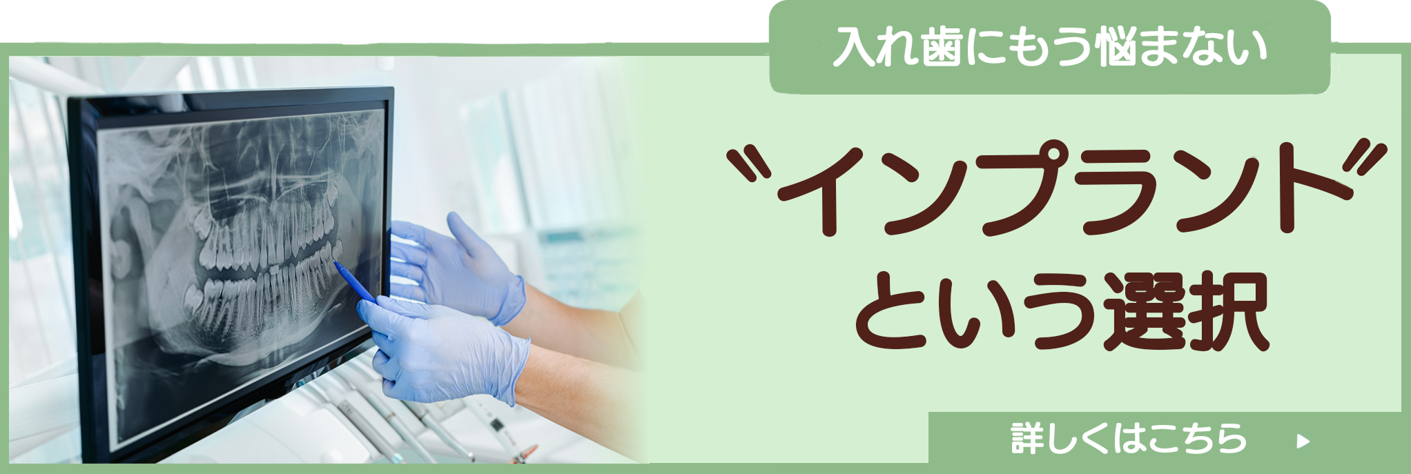 インプラントという選択